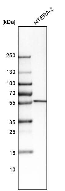Analysis in human cell line NTERA-2.