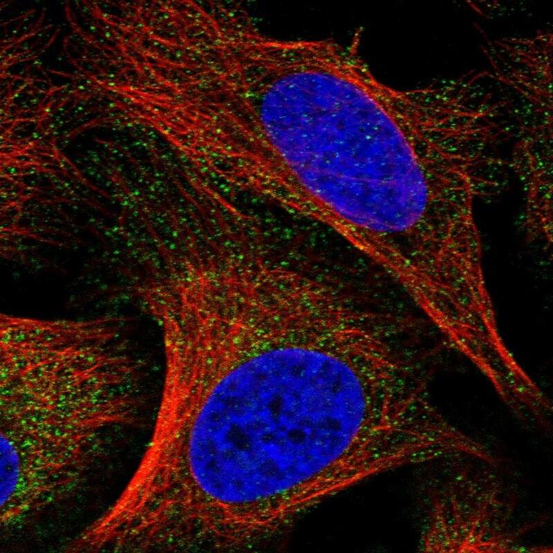 Immunocytochemistry/ Immunofluorescence TPRKB Antibody - BSA Free