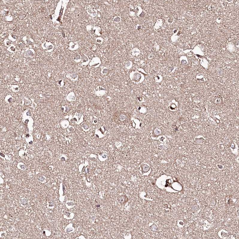 Staining of human cerebral cortex shows weak cytoplasmic positivity in neuronal cells.