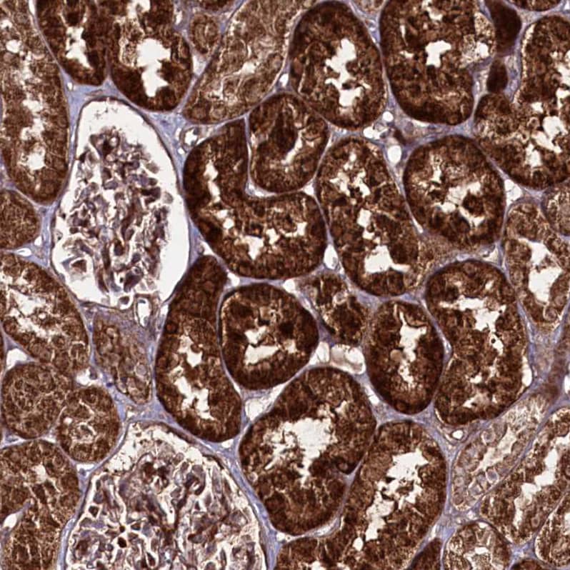 Staining of human kidney shows strong cytoplasmic positivity in cells in tubules.
