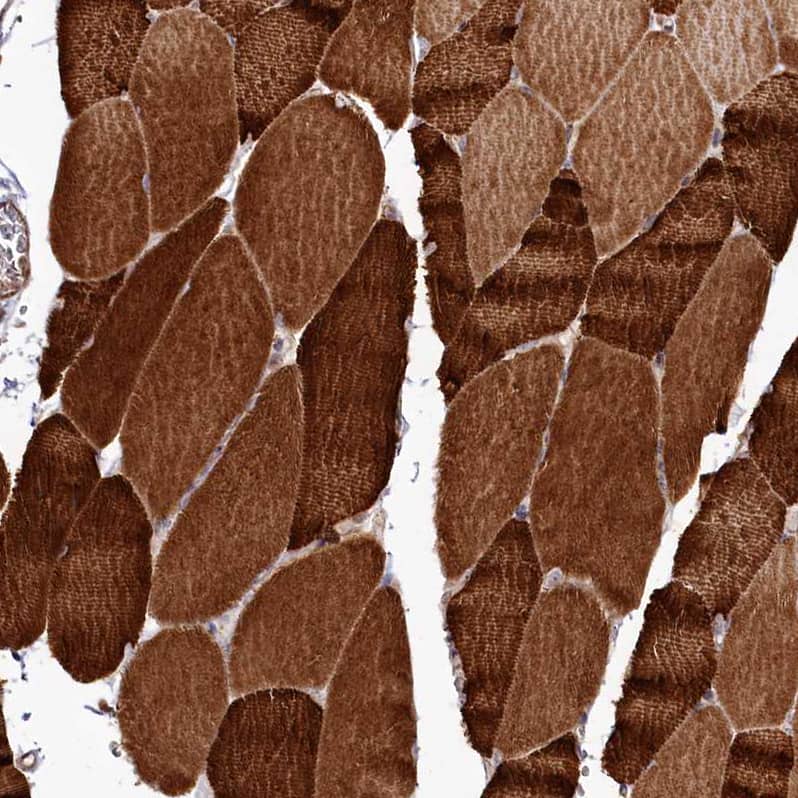 Staining of human skeletal muscle shows strong cytoplasmic positivity in myocytes.