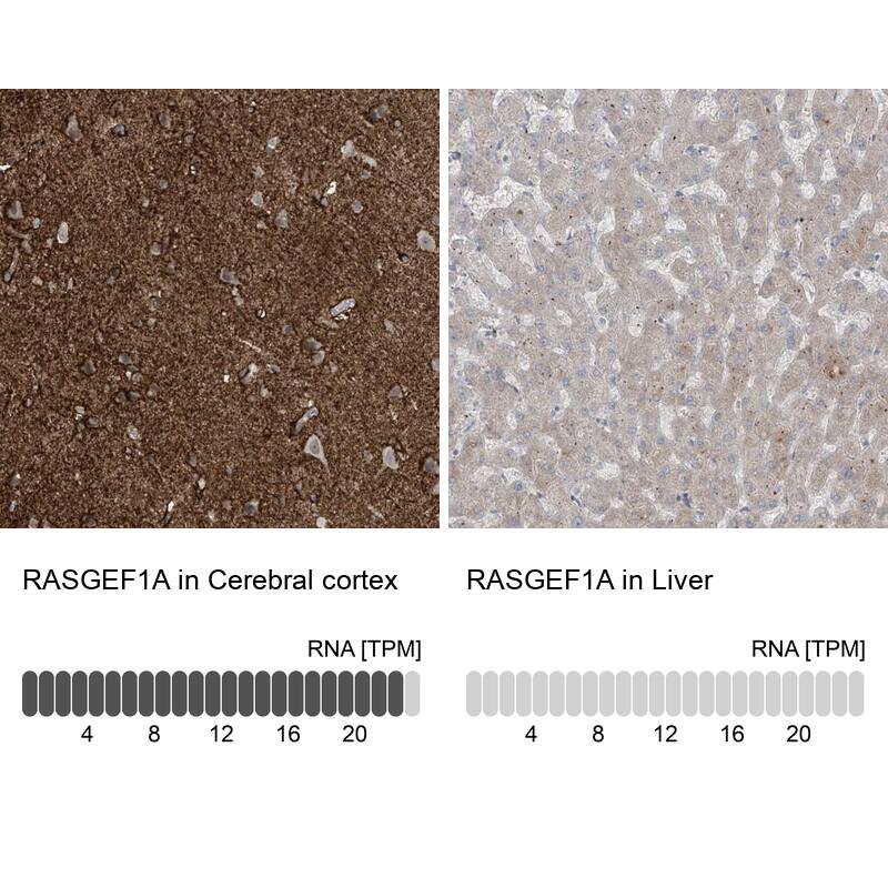 Immunohistochemistry-Paraffin RASGEF1A Antibody - BSA Free