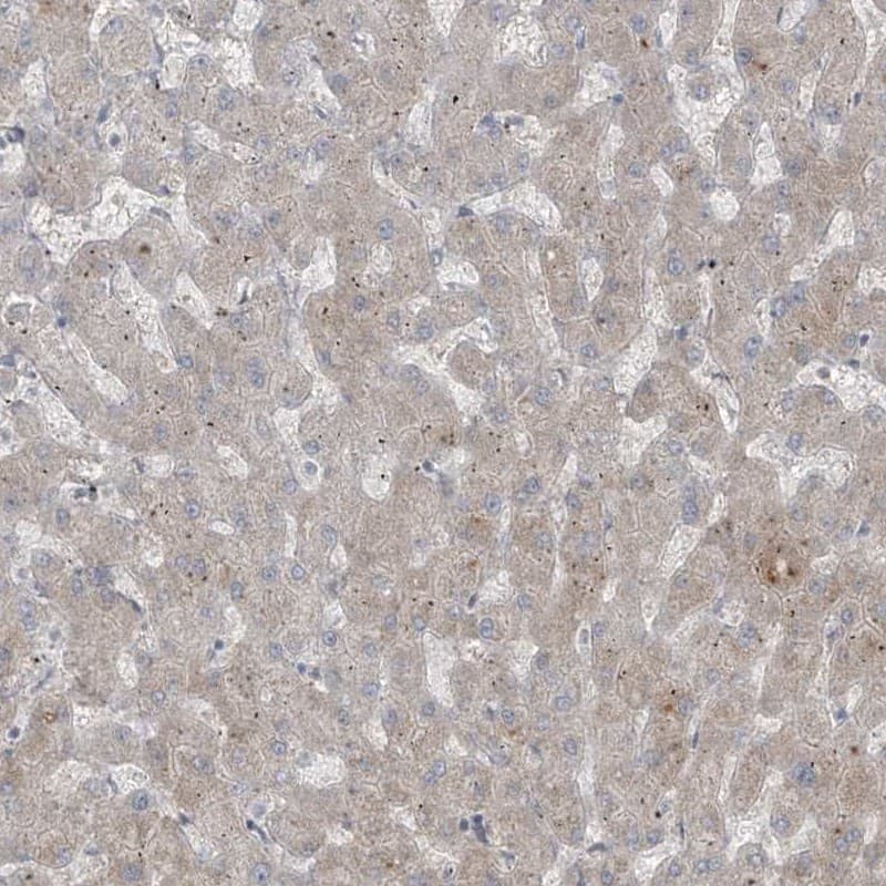 Immunohistochemistry-Paraffin RASGEF1A Antibody - BSA Free