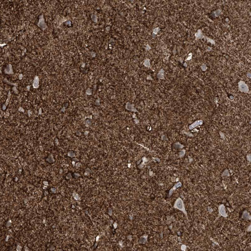 Immunohistochemistry-Paraffin RASGEF1A Antibody - BSA Free