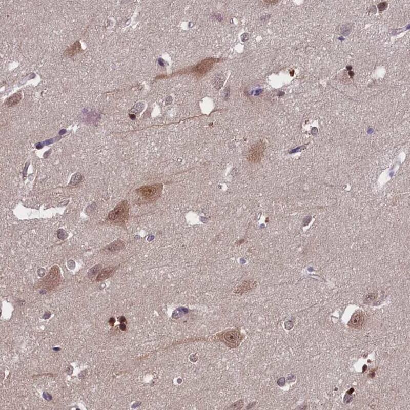 Staining of human cerebral cortex shows cytoplasmic positivity in neuronal cells and glial cells.
