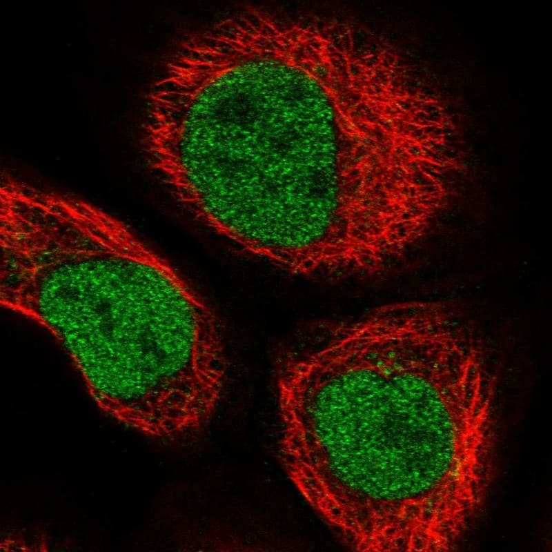 Staining of human cell line A-431 shows localization to nucleoplasm.