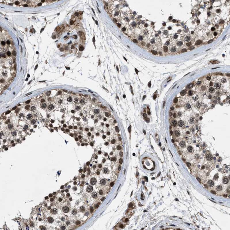 Staining of human testis shows strong nuclear positivity in cells in seminiferous ducts.