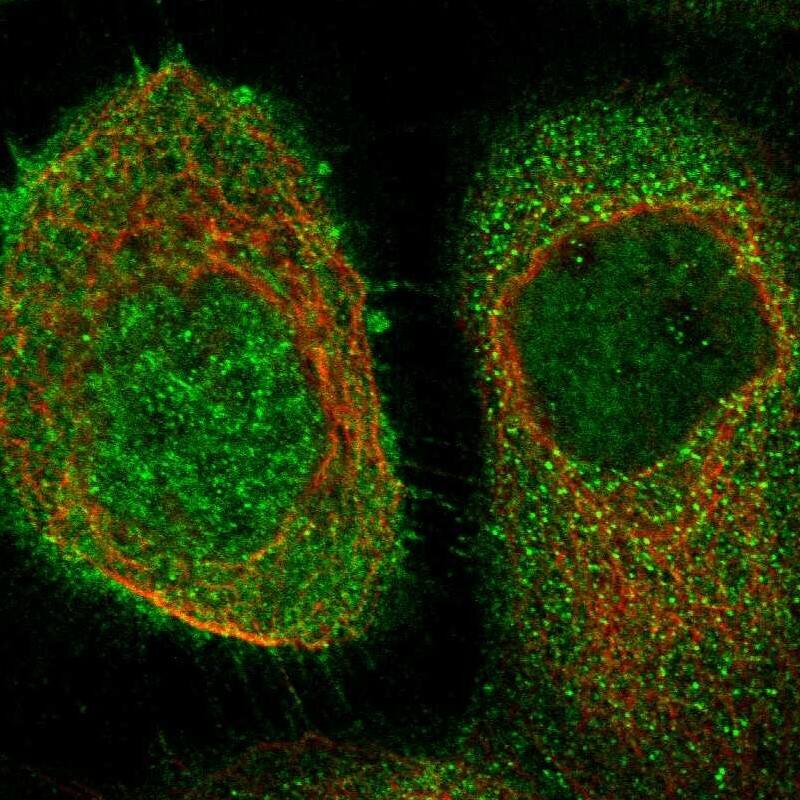 Staining of human cell line A-431 shows localization to nucleus, plasma membrane & cytosol.