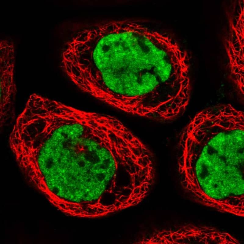Staining of human cell line A-431 shows localization to nucleoplasm & nuclear speckles.
