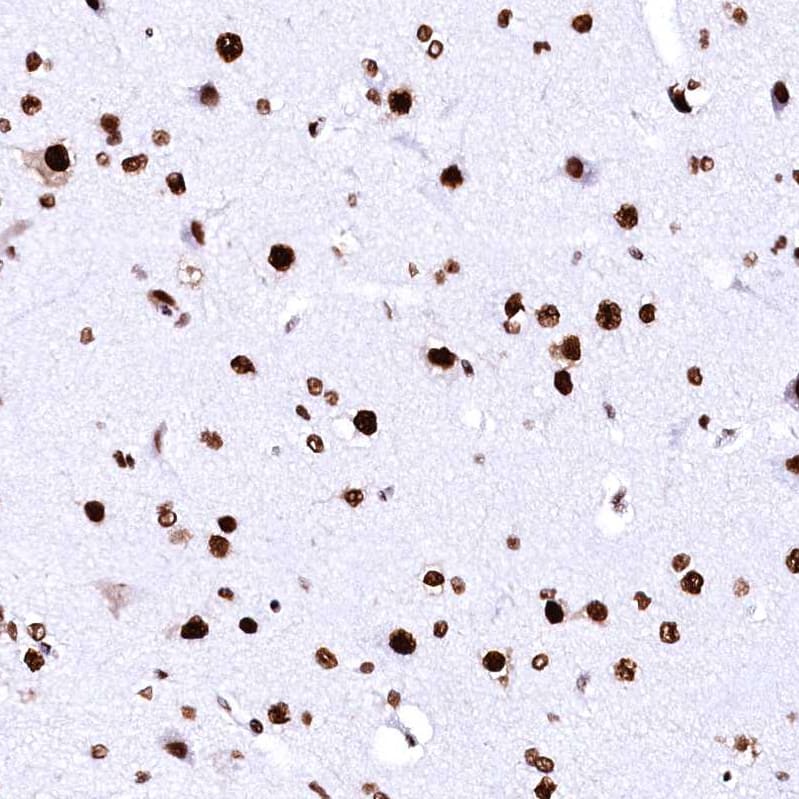 Staining of human cerebral cortex shows strong nuclear positivity in neurons.