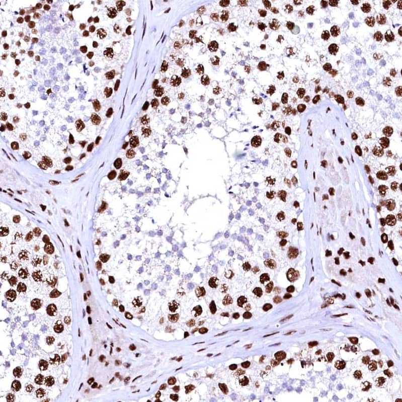 Staining of human testis shows strong nuclear positivity in cells in seminiferous ducts.