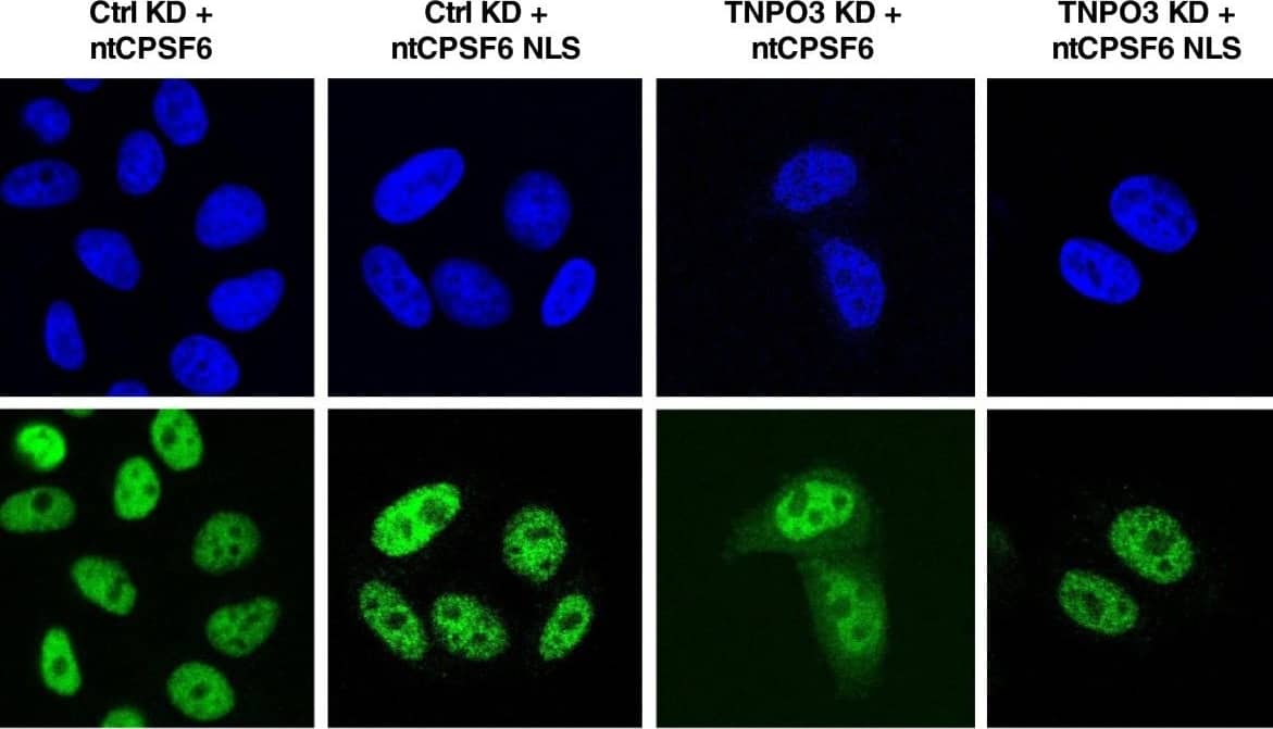 Immunocytochemistry/ Immunofluorescence: CPSF6 Antibody [NBP1-85676] - TNPO3 depletion does not inhibit HIV-1 if CPSF6 is independently targeted to the nucleus. (A) CPSF6 & TNPO3 protein in TZM-bl cells stably transduced with CPSF6 KD vectors, control or TNPO3 KD vectors, & rescue of CPSF6 (ntCPSF6) with or without the SV40 T-Ag NLS. Cell lysate was probed in western blots with anti-TNPO3 antibody (upper panel), anti-CPSF6 antibody (middle panel) & anti-beta -actin antibody (lower panel). (B) Localization of the non-targetable CPSF6 (ntCPSF6) constructs (green) in control (Ctrl) KD or TNPO3 KD TZM-bl cells stably depleted of CPSF6. DAPI staining (blue) was used to mark the nuclear compartment. (C) The pools of stable cell lines in (B) were challenged with WT or CA mutant HIV-1NL4-3GFP reporter viruses. After 72 hrs, GFP expression was checked by flow cytometry. Data represent one of at least three independent experiments. Error bars represent ± SEM (n = 3). Image collected & cropped by CiteAb from the following publication (//retrovirology.biomedcentral.com/articles/10.1186/1742-4690-10-20), licensed under a CC-BY license. Not internally tested by Novus Biologicals.