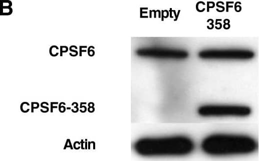 Western Blot: CPSF6 Antibody [NBP1-85676] - The effect of CPSF6-358 on the infectivity of HIV-1 CA mutants correlates with the effect of TNPO3 KD. (A) Schematic representation of the protein domains of WT CPSF6 & the truncated mutant CPSF6-358. RNA recognition motif (RRM), proline-rich domain (P-rich), arginine/serine rich domain (RS). (B) Expression levels of CPSF6 in TZM-bl cells transduced with empty or CPSF6-358 vectors. Cell lysates were probed in western blots with anti-CPSF6 antibody (upper panel) & anti-beta -actin antibody (lower panel). The upper panel shows the endogenous CPSF6 & the truncated form. (C) TZM-bl cells transduced with an empty vector or with a vector encoding CPSF6-358 were challenged with a panel of 27 HIV-1-GFP reporter vectors bearing either WT CA or the indicated CA mutants. At 72 hrs the percent GFP+ cells was determined by flow cytometry as an indication of infectivity. The ratio of HIV-1 infectivity in CPSF6-358 expressing cells & empty vector cells is shown. White bars show CA mutants inhibited to a similar extent as the WT virus by CPSF6-358, black bars shows CA mutants insensitive or slightly sensitive to CPSF6-358, & gray bars show CA mutants hypersensitive to the presence of CPSF6-358 in the cell. (D) Correlation between the infectivity ratios of the 27 CA mutants when infecting Ctrl KD vs TNPO3 KD [8] & Empty vector vs CPSF6-358 (R2 = 0.8528). Image collected & cropped by CiteAb from the following publication (//retrovirology.biomedcentral.com/articles/10.1186/1742-4690-10-20), licensed under a CC-BY license. Not internally tested by Novus Biologicals.