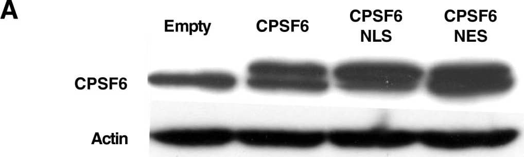 Western Blot: CPSF6 Antibody [NBP1-85676] - HIV-1 replication is inhibited when full-length CPSF6 is targeted to the cytoplasm. (A) Expression levels of CPSF6 in TZM-bl cells transduced with empty, CPSF6, CPSF6-NLS & CPSF6-NES vectors. Cell lysates were probed in western blots with anti-CPSF6 antibody (upper panel) & anti-beta -actin antibody (lower panel). The upper panel shows the endogenous & exogenous full-length CPSF6 with an HA tag. (B) Localization of different forms of CPSF6 in TZM-bl cells stably expressing CPSF6, CPSF6 NLS or CPSF6 NES. The cells were stained with an anti-HA antibody (green) for the detection of the CPSF6 proteins. DAPI staining (blue) was used to mark the nuclear compartment. (C) TZM-bl stably expressing the different forms of CPSF6 were challenged with WT or CA mutant HIV-1NL4-3GFP reporter viruses. After 72 hours, GFP reporter expression was assessed by flow cytometry. Data represent one of at least three independent experiments. Error bars represent ± SEM (n = 3). Image collected & cropped by CiteAb from the following publication (//retrovirology.biomedcentral.com/articles/10.1186/1742-4690-10-20), licensed under a CC-BY license. Not internally tested by Novus Biologicals.