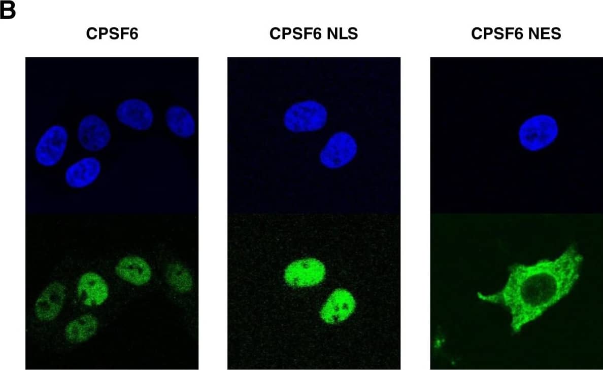 Western Blot: CPSF6 Antibody [NBP1-85676] - HIV-1 replication is inhibited when full-length CPSF6 is targeted to the cytoplasm. (A) Expression levels of CPSF6 in TZM-bl cells transduced with empty, CPSF6, CPSF6-NLS & CPSF6-NES vectors. Cell lysates were probed in western blots with anti-CPSF6 antibody (upper panel) & anti-beta -actin antibody (lower panel). The upper panel shows the endogenous & exogenous full-length CPSF6 with an HA tag. (B) Localization of different forms of CPSF6 in TZM-bl cells stably expressing CPSF6, CPSF6 NLS or CPSF6 NES. The cells were stained with an anti-HA antibody (green) for the detection of the CPSF6 proteins. DAPI staining (blue) was used to mark the nuclear compartment. (C) TZM-bl stably expressing the different forms of CPSF6 were challenged with WT or CA mutant HIV-1NL4-3GFP reporter viruses. After 72 hours, GFP reporter expression was assessed by flow cytometry. Data represent one of at least three independent experiments. Error bars represent ± SEM (n = 3). Image collected & cropped by CiteAb from the following publication (//retrovirology.biomedcentral.com/articles/10.1186/1742-4690-10-20), licensed under a CC-BY license. Not internally tested by Novus Biologicals.