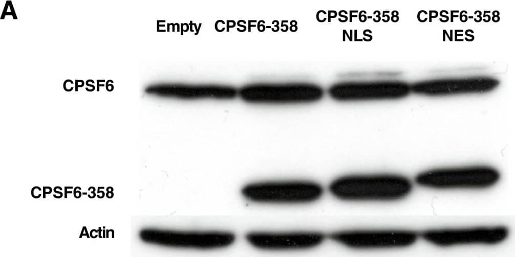 Western Blot: CPSF6 Antibody [NBP1-85676] - CPSF6-358 inhibits HIV-1 replication when localized to the cytoplasm. (A) CPSF6 protein in TZM-bl cells transduced with empty, CPSF6-358, CPSF6-358 NLS & CPSF6-358 NES vectors. Cell lysates were probed in western blots with anti-CPSF6 antibody (upper panel) & anti-beta -actin antibody (lower panel). The upper panel shows the endogenous CPSF6 & the truncated form. (B) Indirect immunofluorescence showing localization of the different forms of CPSF6-358. The TZM-bl cells, transduced as in (A), were stained with an anti-HA antibody (green) for the detection of the CPSF6-358 proteins. DAPI was used to mark the nuclear compartment (blue). (C) TZM-bl stably expressing the different forms of CPSF6-358 were challenged with WT or CA mutant HIV-1NL4-3GFP reporter viruses. After 72 hrs, GFP reporter expression was assessed by flow cytometry. Data represent one of at least three independent experiments. Error bars represent ± SEM (n = 3). Image collected & cropped by CiteAb from the following publication (//retrovirology.biomedcentral.com/articles/10.1186/1742-4690-10-20), licensed under a CC-BY license. Not internally tested by Novus Biologicals.