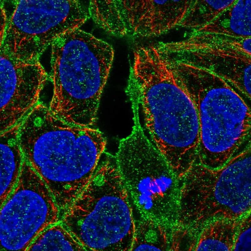 Staining of human cell line RT4 shows localization to plasma membrane & aggresome.