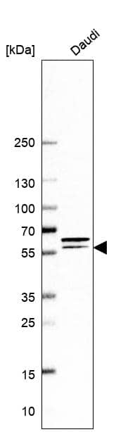 Analysis in human cell line Daudi.