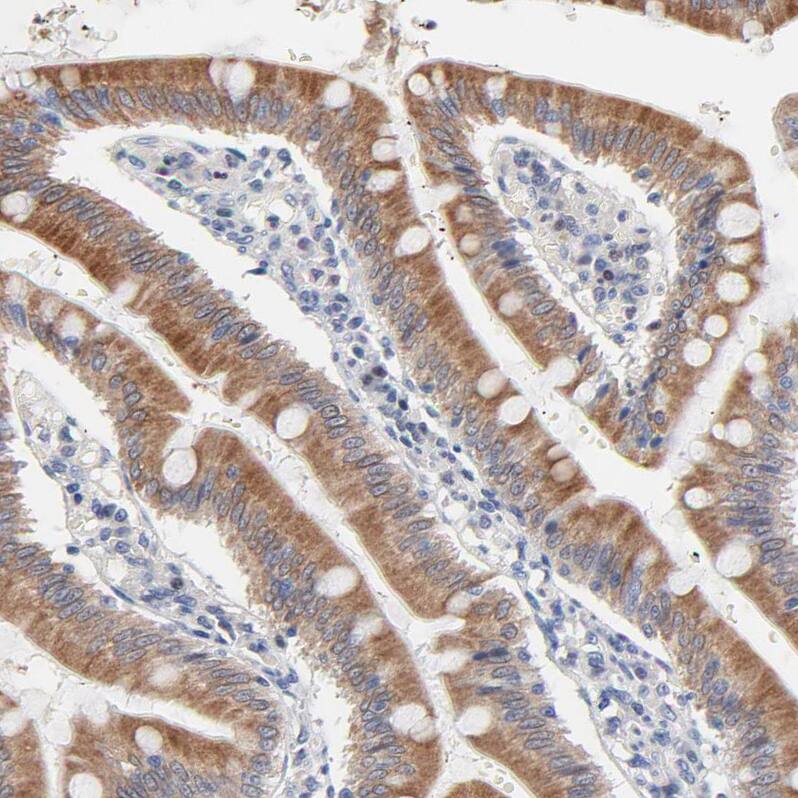 Staining of human small intestine shows moderate cytoplasmic positivity in glandular cells.