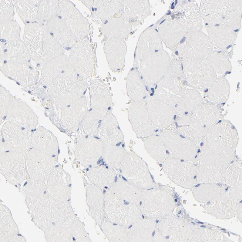 Staining of human skeletal muscle shows no positivity in myocytes as expected.