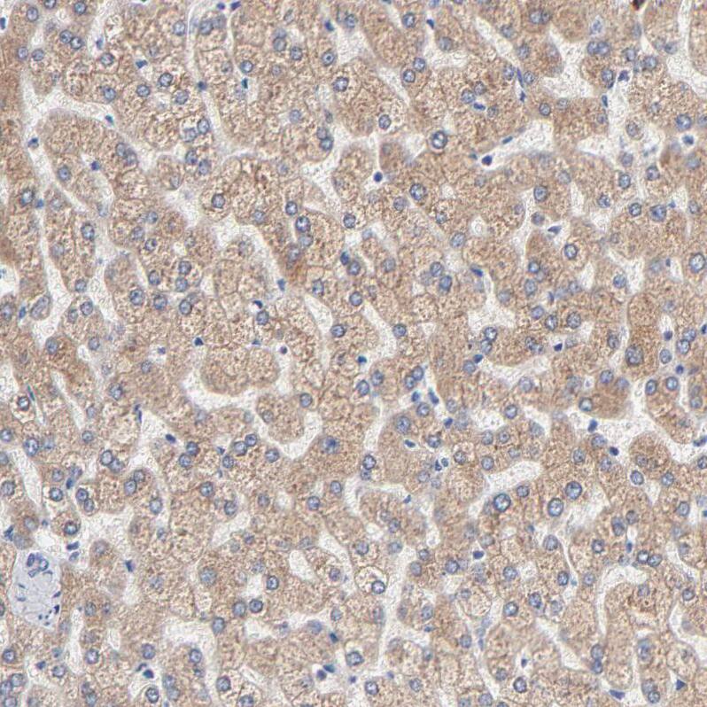 Staining of human liver shows moderate cytoplasmic positivity in hepatocytes.