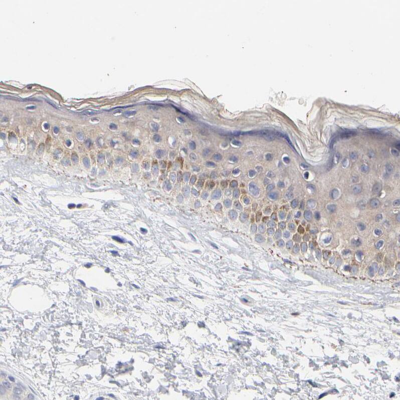 Immunohistochemistry-Paraffin AADAC Antibody - BSA Free