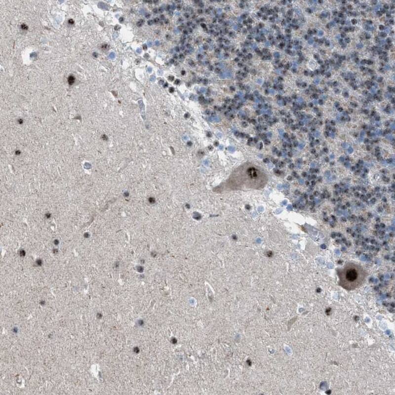 Immunohistochemistry-Paraffin CENPP Antibody - BSA Free