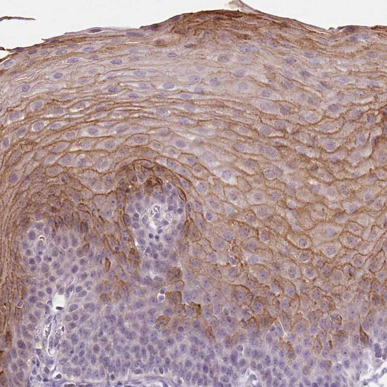 Staining of human esophagus shows moderate membranous positivity in squamous epithelial cells.