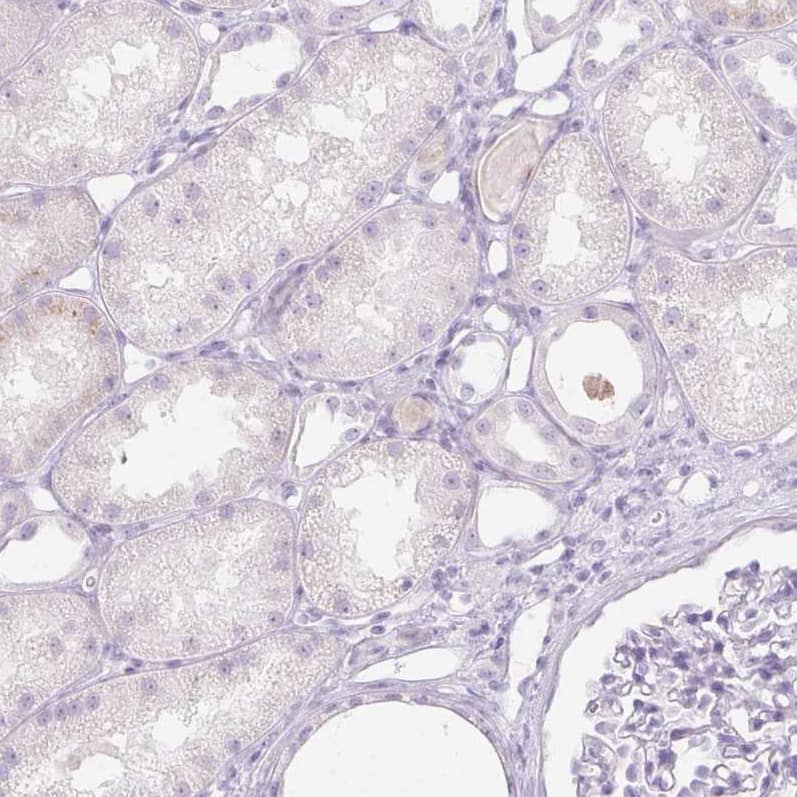 Staining of human kidney shows no positivity in cells in tubules as expected.