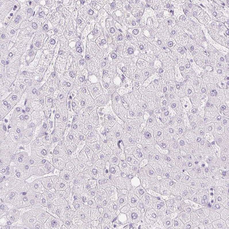 Staining of human liver shows no positivity in hepatocytes as expected.