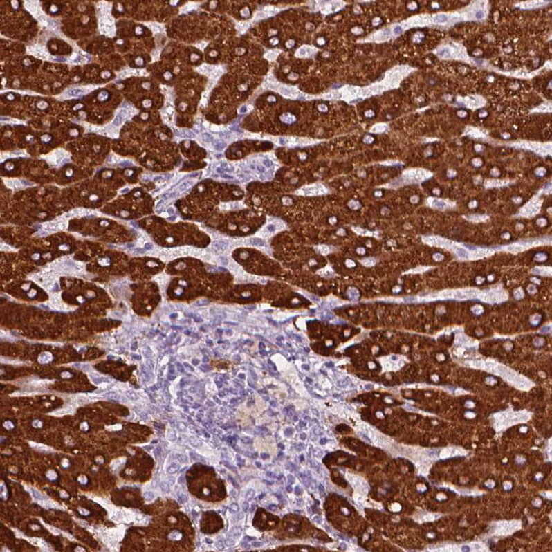 Staining of human liver shows strong cytoplasmic positivity in hepatocytes.