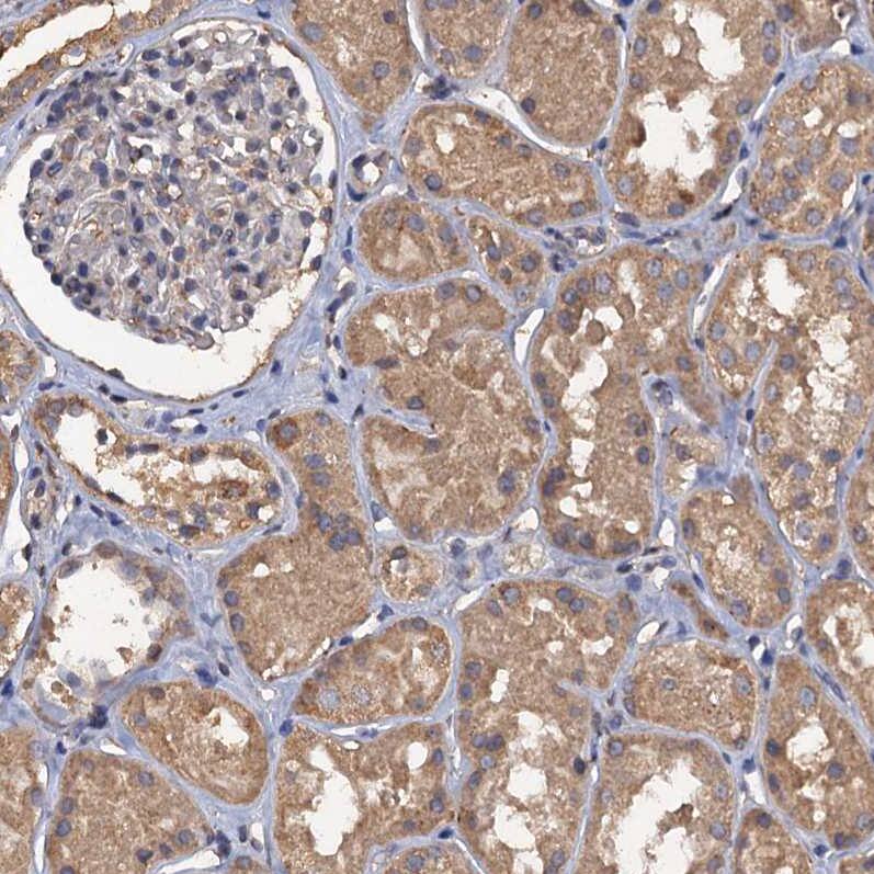 Staining of human kidney shows moderate cytoplasmic positivity in cells in tubules.