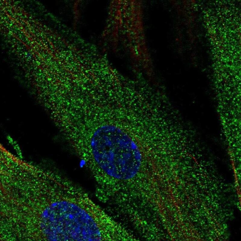 Staining of human cell line ASC TERT1 shows localization to plasma membrane.
