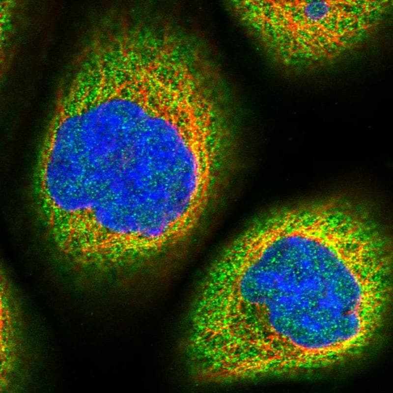 Staining of human cell line A-431 shows localization to cytosol.