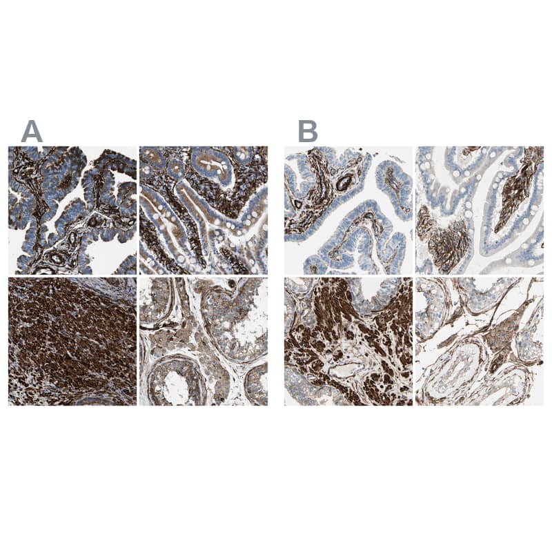 <b>Independent Antibodies Validation. </b>Staining of human fallopian tube, gastrointestinal, prostate and testis using Anti-CALD1 antibody NBP1-85701 (A) shows similar protein distribution across tissues to independent antibody NBP1-85702 (B).