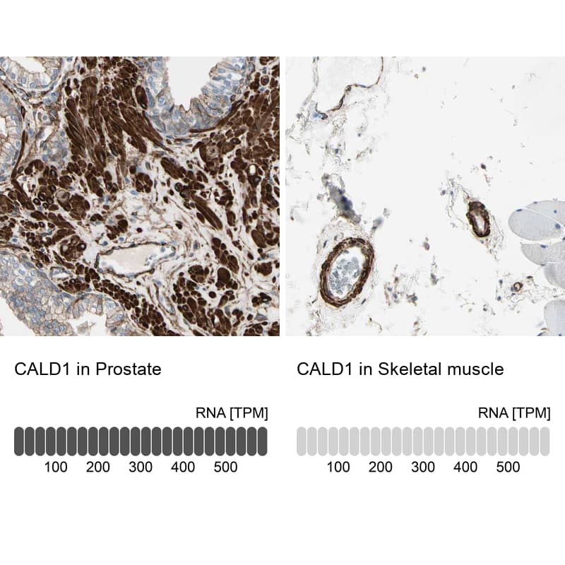 <b>Orthogonal Strategies Validation. </b>Analysis in human prostate and skeletal muscle tissues using HPA008066 antibody. Corresponding CALD1 RNA-seq data are presented for the same tissues.