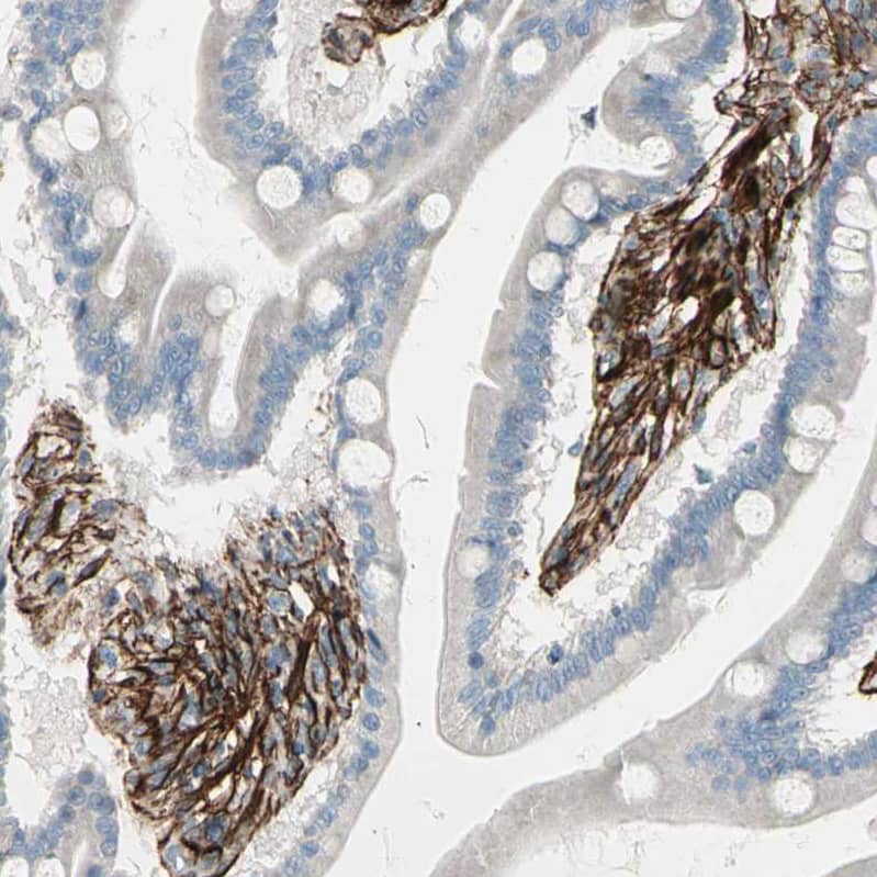 Staining of human duodenum shows strong cytoplasmic positivity in smooth muscle cells.