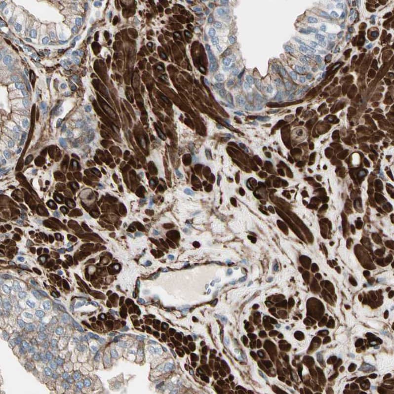 Staining of human prostate shows strong cytoplasmic positivity in smooth muscle cells.