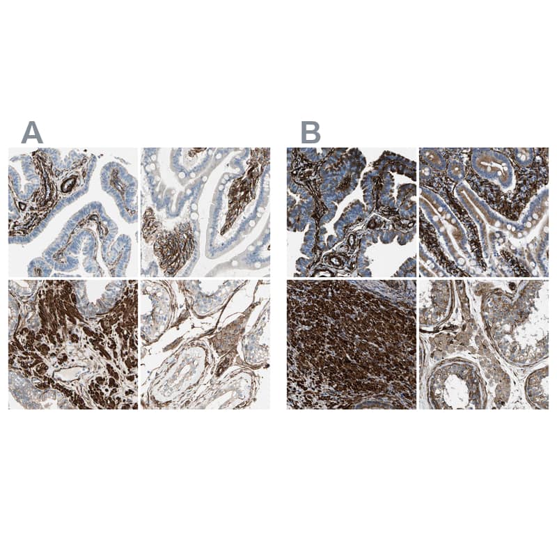 <b>Independent Antibodies Validation. </b>Staining of human fallopian tube, gastrointestinal, prostate and testis using Anti-CALD1 antibody NBP1-85702 (A) shows similar protein distribution across tissues to independent antibody NBP1-85701 (B).