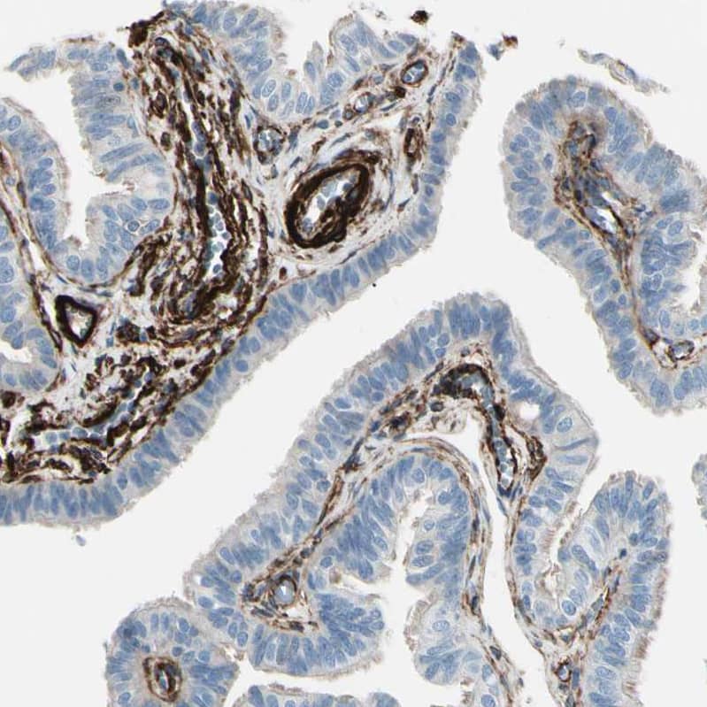 Staining of human fallopian tube shows strong cytoplasmic positivity in smooth muscle cells and blood vessles.