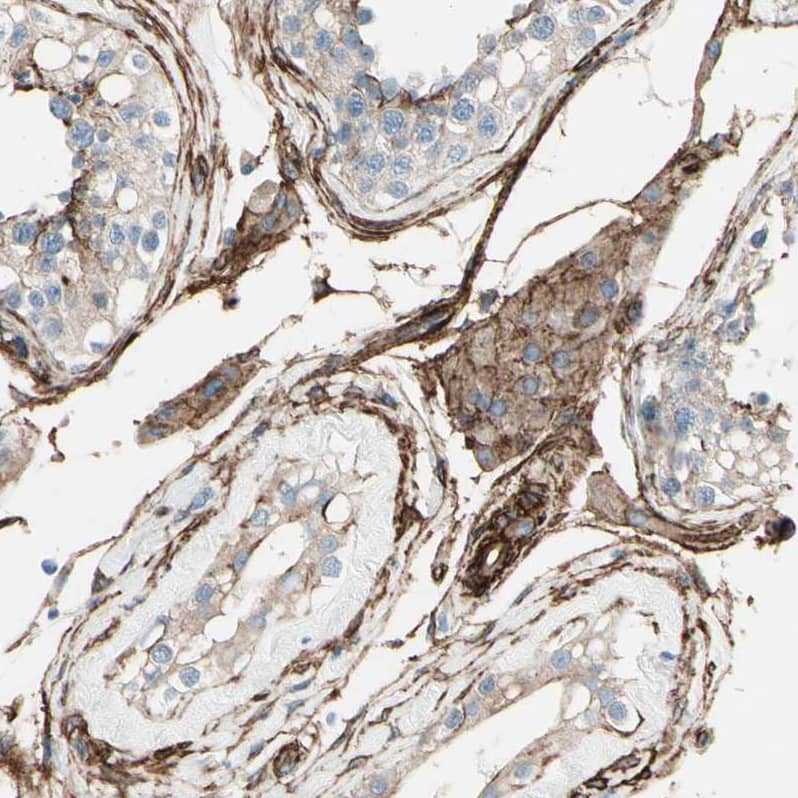 Staining of human testis shows strong cytoplasmic positivity in peritubular myoid cells.