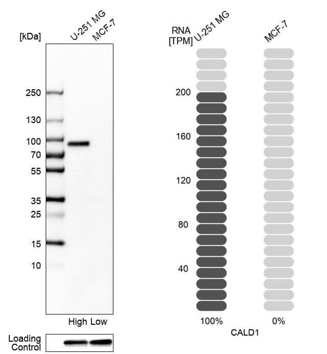 Analysis in human cell lines U-251MG and MCF-7 using Anti-CALD1 antibody. Corresponding CALD1 RNA-seq data are presented for the same cell lines. Loading control: Anti-GAPDH.