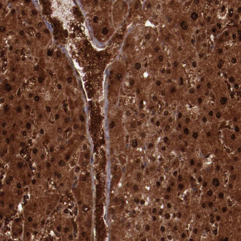 Immunohistochemistry-Paraffin FTSJ1 Antibody - BSA Free