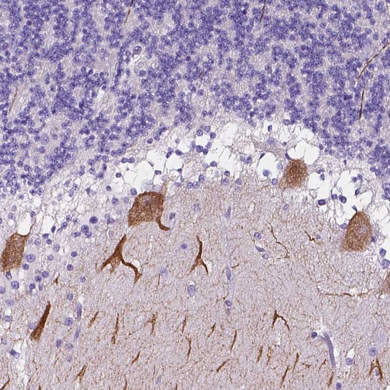 Immunohistochemistry-Paraffin Calsyntenin-2 Antibody - BSA Free