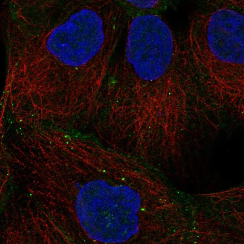 Staining of human cell line A-431 shows localization to plasma membrane, cell junctions & vesicles.