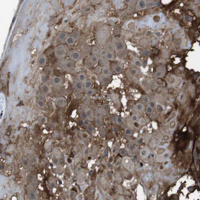 Staining of human placenta shows strong membranous positivity in decidual cells.