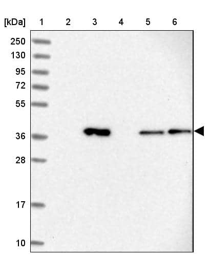 Lane 1: Marker [kDa] 250, 130, 95, 72, 55, 36, 28, 17, 10Lane 2: Human cell line RT-4Lane 3: Human cell line U-251MG spLane 4: Human plasma (IgG/HSA depleted)Lane 5: Human liver tissueLane 6: Human tonsil tissue