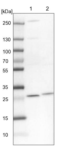 <b>Independent Antibodies Validation. </b>Lane 1: NIH-3T3 cell lysate (Mouse embryonic fibroblast cells)Lane 2: NBT-II cell lysate (Rat Wistar bladder tumour cells)