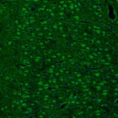 Staining of mouse cingulate cortex shows cytoplasmic immunoreactivity in neurons.