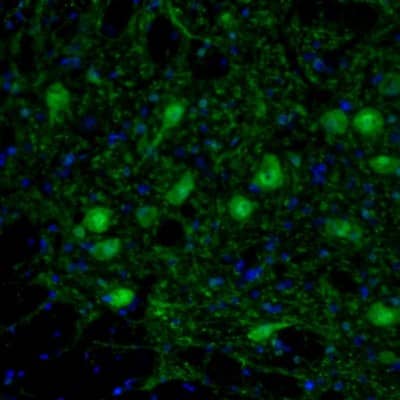Staining of mouse brain shows neuronal staining in lateral paragigantocellular nucleus.